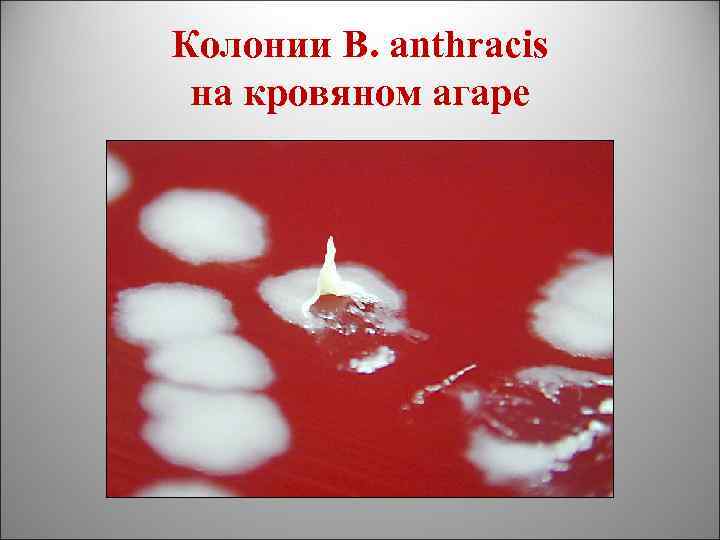 Колонии B. anthracis на кровяном агаре 