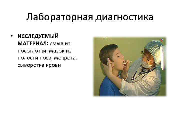 Лабораторная диагностика • ИССЛЕДУЕМЫЙ МАТЕРИАЛ: смыв из носоглотки, мазок из полости носа, мокрота, сыворотка