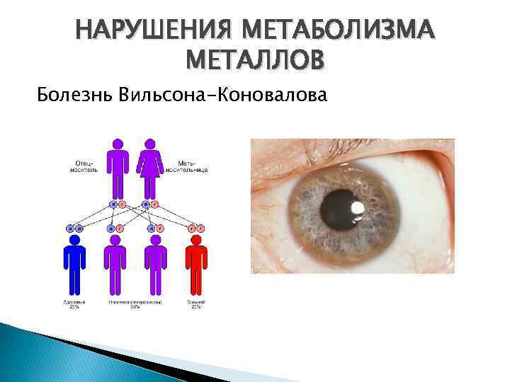 НАРУШЕНИЯ МЕТАБОЛИЗМА МЕТАЛЛОВ Болезнь Вильсона-Коновалова 