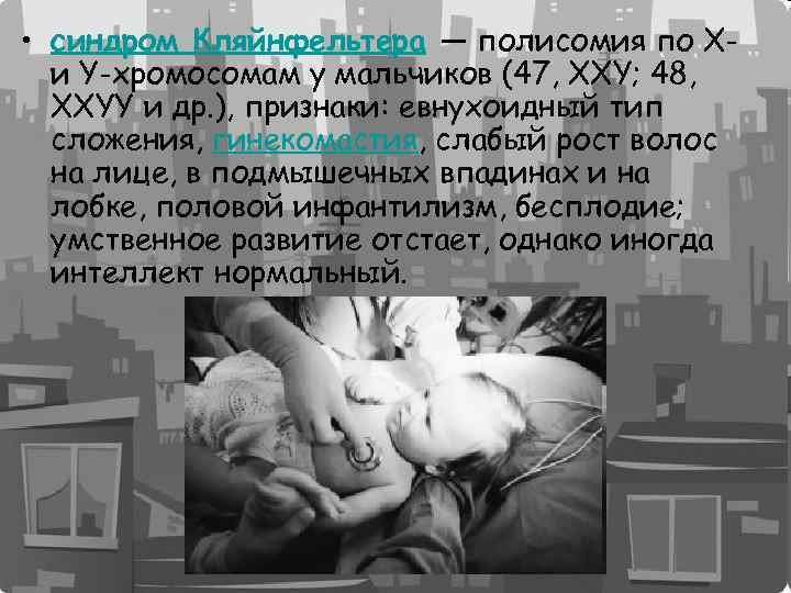  • синдром Кляйнфельтера — полисомия по Xи Y-хромосомам у мальчиков (47, XXY; 48,