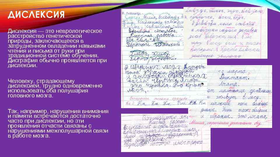 ДИСЛЕКСИЯ Дислексия — это неврологическое расстройство генетической природы, заключающееся в затрудненном овладении навыками чтения
