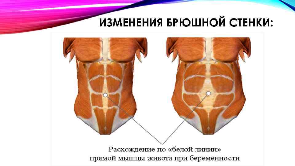 ИЗМЕНЕНИЯ БРЮШНОЙ СТЕНКИ: 