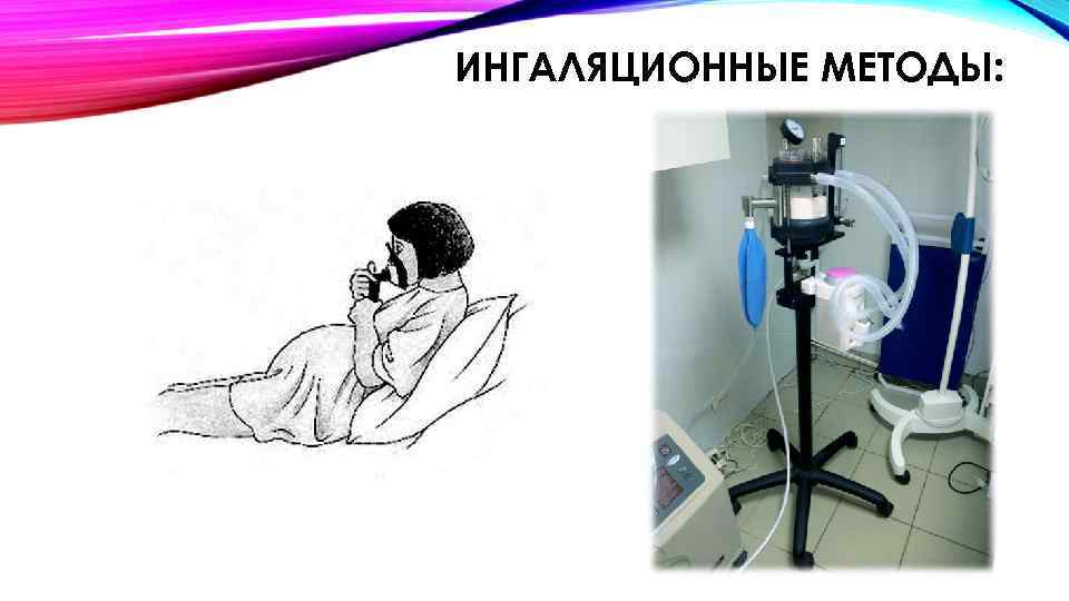 ИНГАЛЯЦИОННЫЕ МЕТОДЫ: 