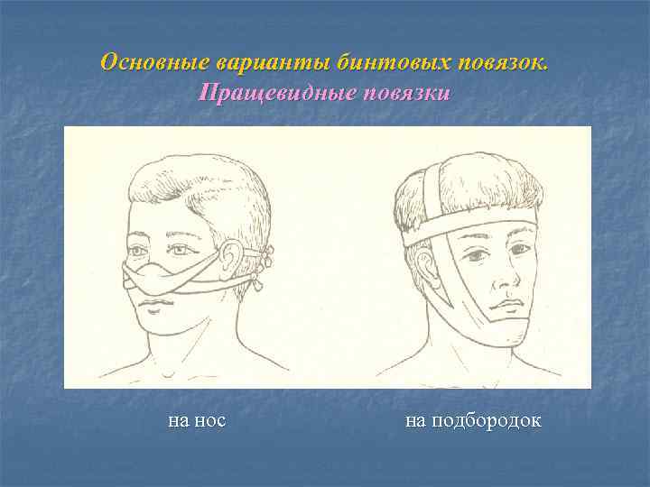 Основные варианты бинтовых повязок. Пращевидные повязки на нос на подбородок 