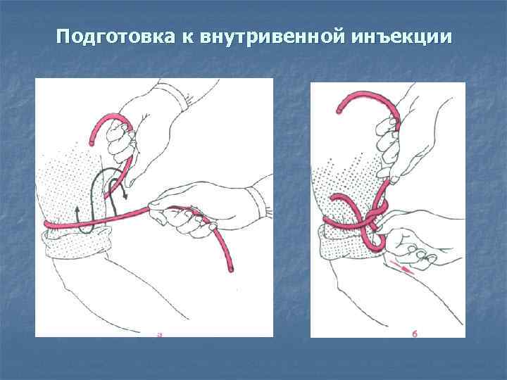 Подготовка к внутривенной инъекции 