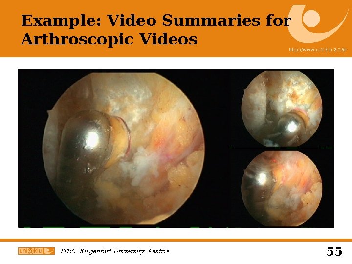 Example: Video Summaries for Arthroscopic Videos http: //www. uni-klu. ac. at ITEC, Klagenfurt University,