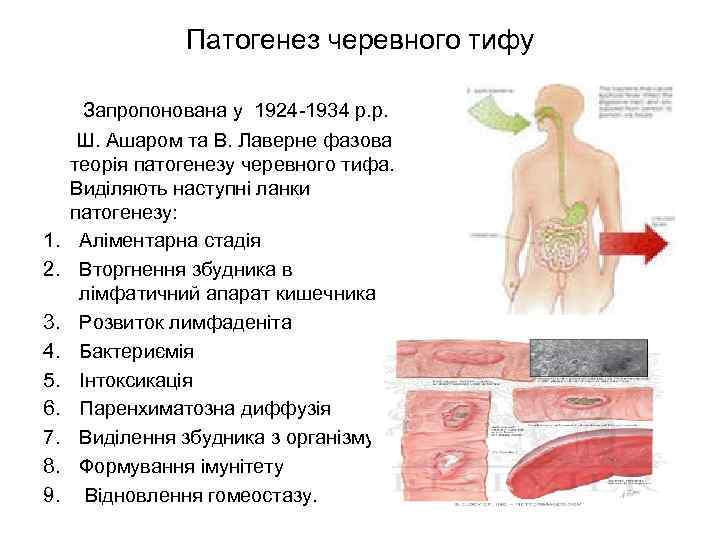 Патогенез черевного тифу Запропонована у 1924 -1934 р. р. Ш. Ашаром та В. Лаверне