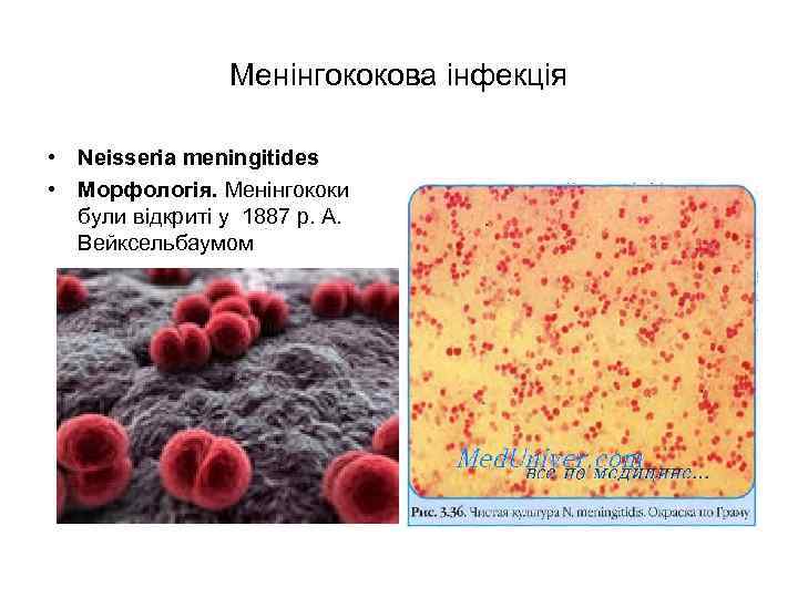 Менінгококова інфекція • Neisseria meningitides • Морфологія. Менінгококи були відкриті у 1887 р. А.