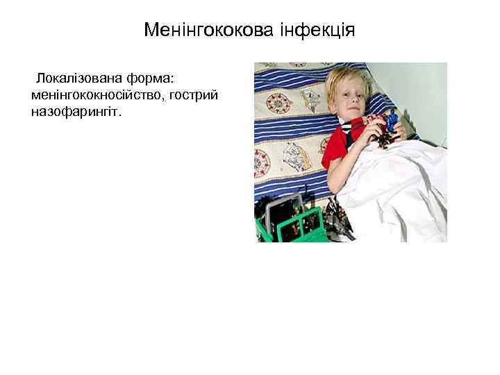 Менінгококова інфекція Локалізована форма: менінгококносійство, гострий назофарингіт. 