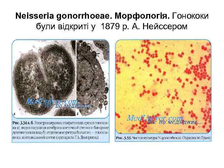 Neisseria gonorrhoeae. Морфологія. Гонококи були відкриті у 1879 р. А. Нейссером 