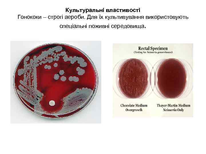 Культуральні властивості Гонококи – строгі аероби. Для їх культивування використовують спеціальні поживні середовища. 