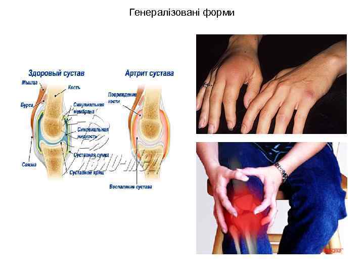 Генералізовані форми 