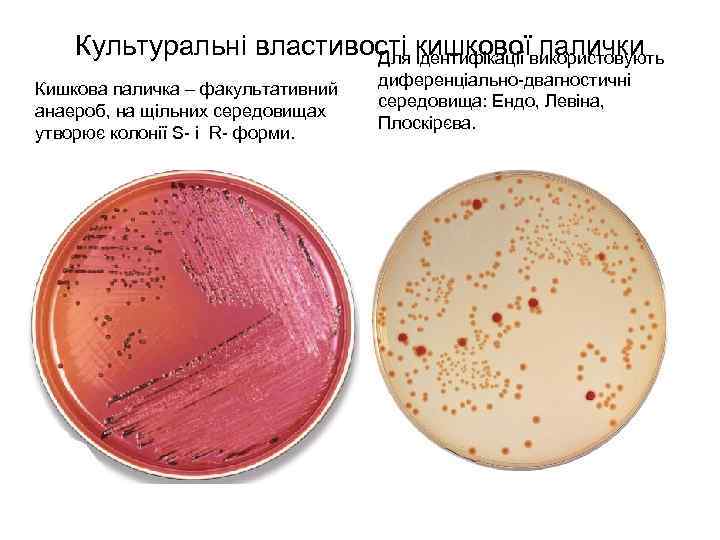 Культуральні властивості кишкової палички Для ідентифікації використовують Кишкова паличка – факультативний анаероб, на щільних