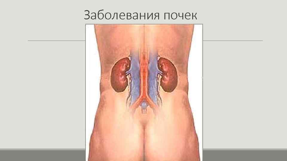 Почки справа у мужчин. Анатомия человека почки расположение. Расположение почек спереди. Расположение почек у человека спереди.