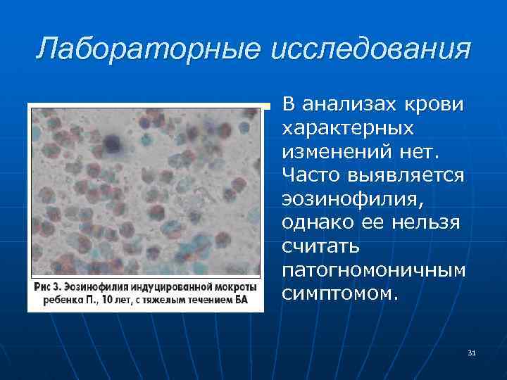 Лабораторные исследования n В анализах крови характерных изменений нет. Часто выявляется эозинофилия, однако ее