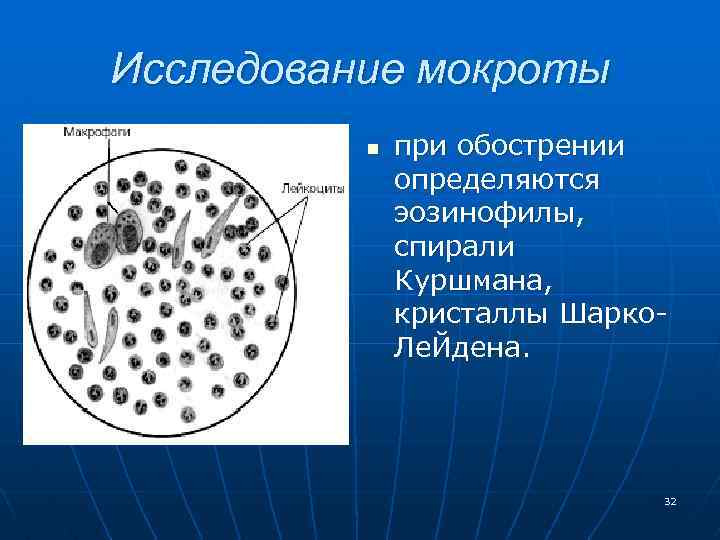 Исследование мокроты n при обострении определяются эозинофилы, спирали Куршмана, кристаллы Шарко Ле. Йдена. 32