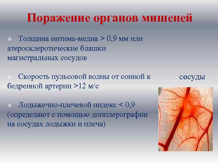 Поражение органов мишеней Толщина интима-медиа > 0, 9 мм или атеросклеротические бляшки магистральных сосудов