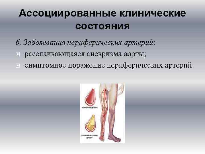 Ассоциированные клинические состояния 6. Заболевания периферических артерий: расслаивающаяся аневризма аорты; симптомное поражение периферических артерий