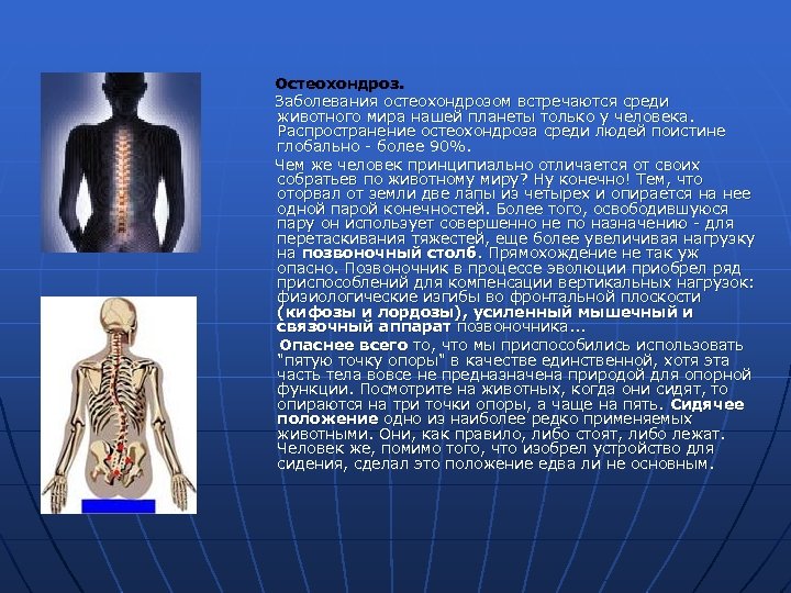  Остеохондроз. Заболевания остеохондрозом встречаются среди животного мира нашей планеты только у человека. Распространение