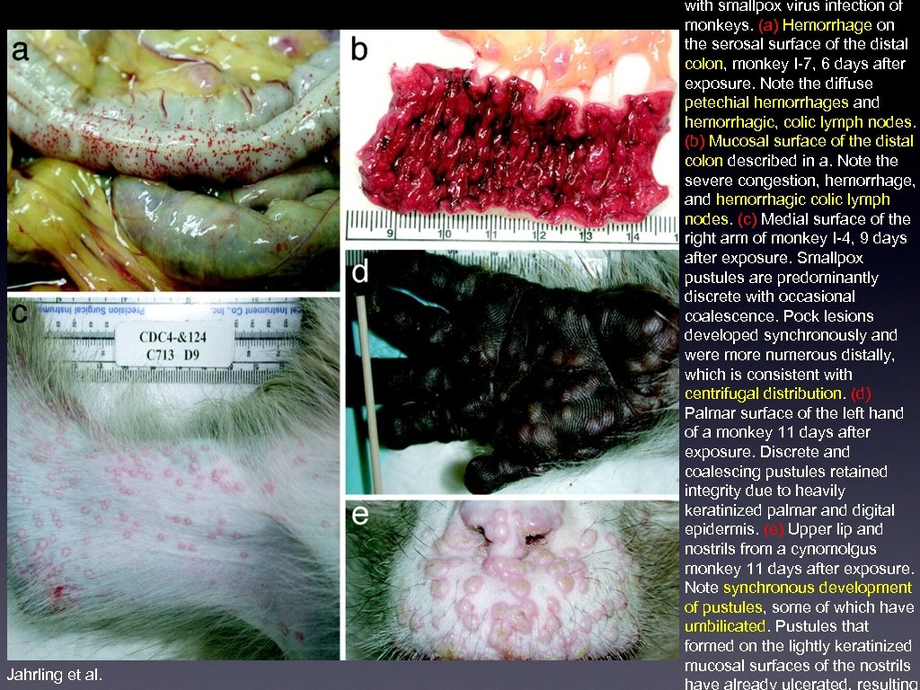 Jahrling et al. with smallpox virus infection of monkeys. (a) Hemorrhage on the serosal