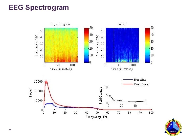 EEG Spectrogram 38 