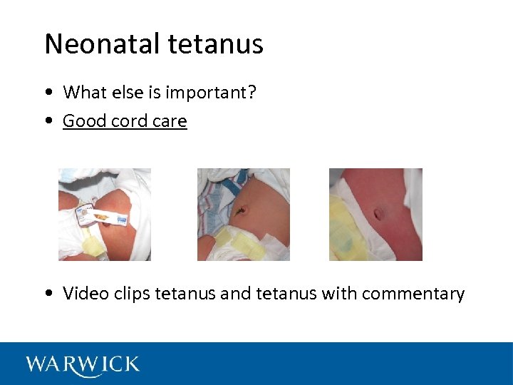 Neonatal tetanus • What else is important? • Good cord care • Video clips
