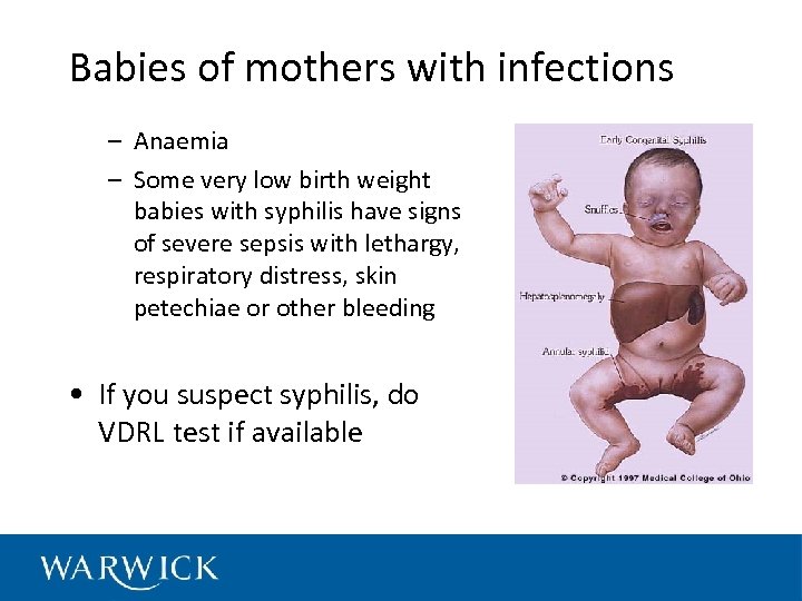Babies of mothers with infections – Anaemia – Some very low birth weight babies