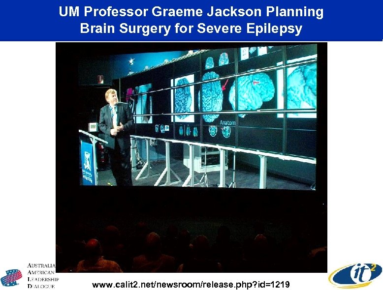 UM Professor Graeme Jackson Planning Brain Surgery for Severe Epilepsy www. calit 2. net/newsroom/release.