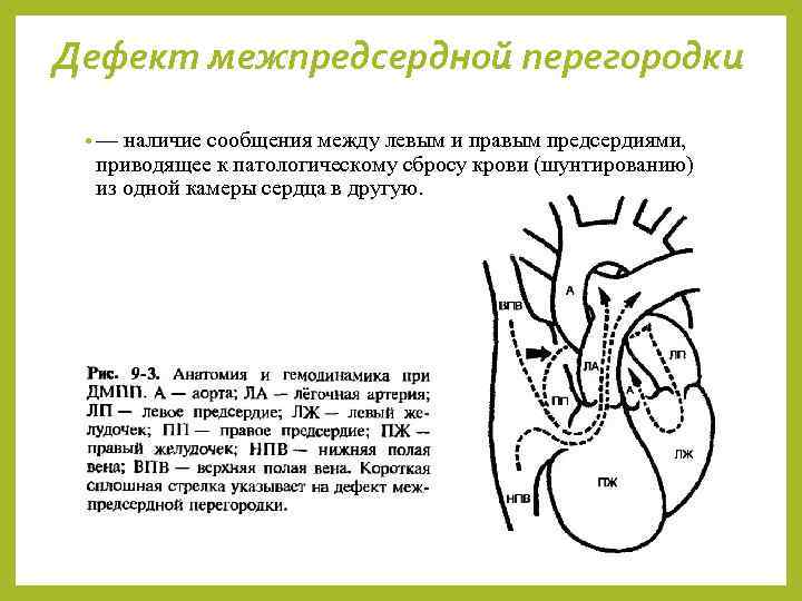 Дефект межпредсердной перегородки • — наличие сообщения между левым и правым предсердиями, приводящее к