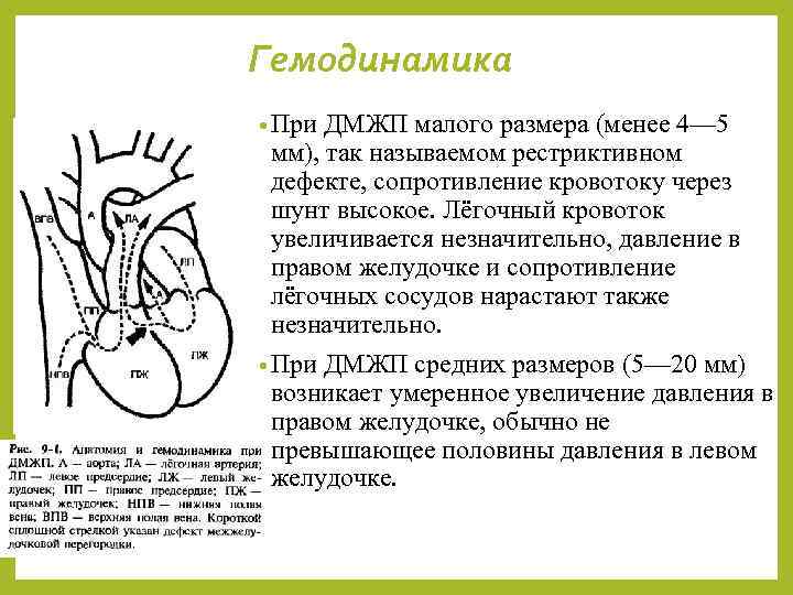 Гемодинамика • При ДМЖП малого размера (менее 4— 5 мм), так называемом рестриктивном дефекте,