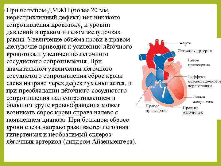  • При большом ДМЖП (более 20 мм, нерестриктивный дефект) нет никакого сопротивления кровотоку,