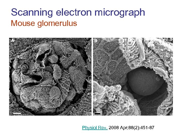 Scanning electron micrograph Mouse glomerulus Physiol Rev. 2008 Apr; 88(2): 451 -87 