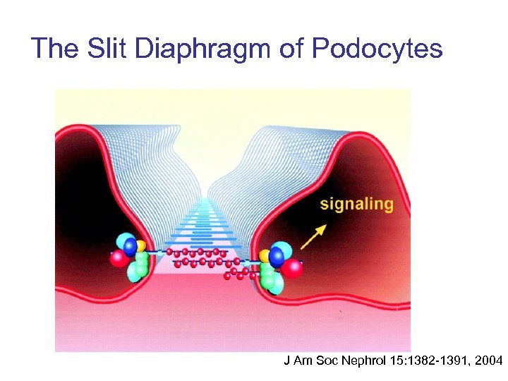 The Slit Diaphragm of Podocytes J Am Soc Nephrol 15: 1382 -1391, 2004 