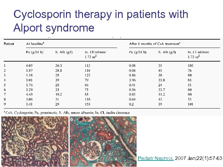 Cyclosporin therapy in patients with Alport syndrome Pediatr Nephrol. 2007 Jan; 22(1): 57 -63