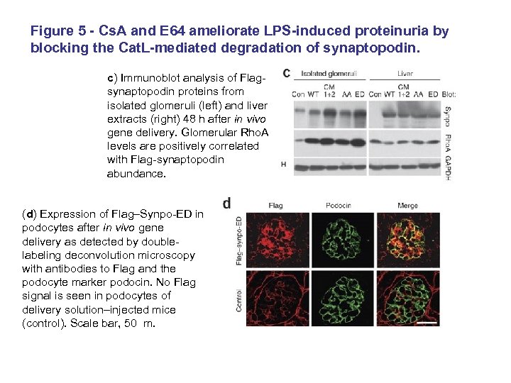 Figure 5 - Cs. A and E 64 ameliorate LPS-induced proteinuria by blocking the