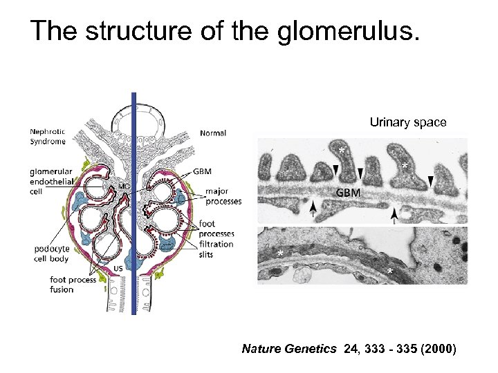 The structure of the glomerulus. Urinary space Nature Genetics 24, 333 - 335 (2000)