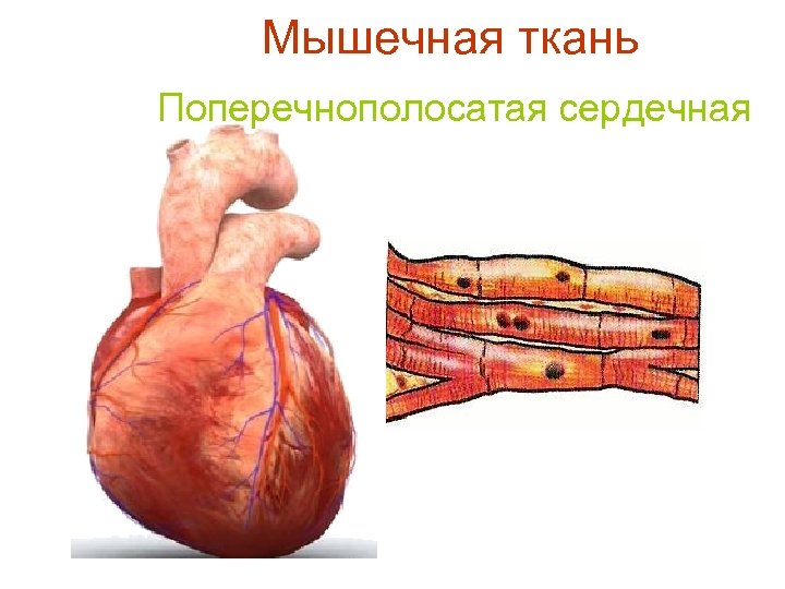 Мышечная ткань Поперечнополосатая сердечная 
