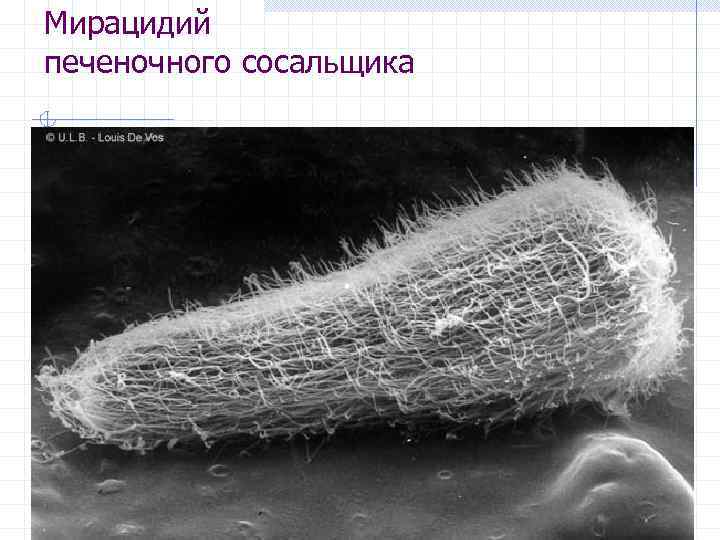 Мирацидий печеночного сосальщика 