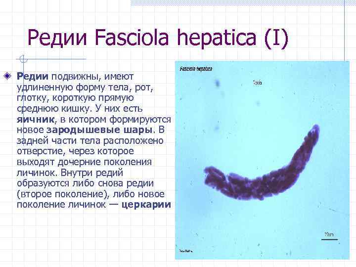 Редии Fasciola hepatica (I) Редии подвижны, имеют удлиненную форму тела, рот, глотку, короткую прямую