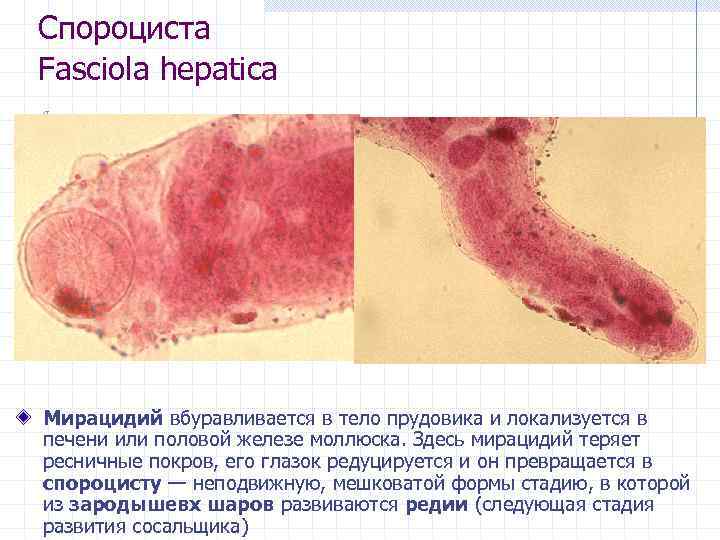 Спороциста Fasciola hepatica Мирацидий вбуравливается в тело прудовика и локализуется в печени или половой