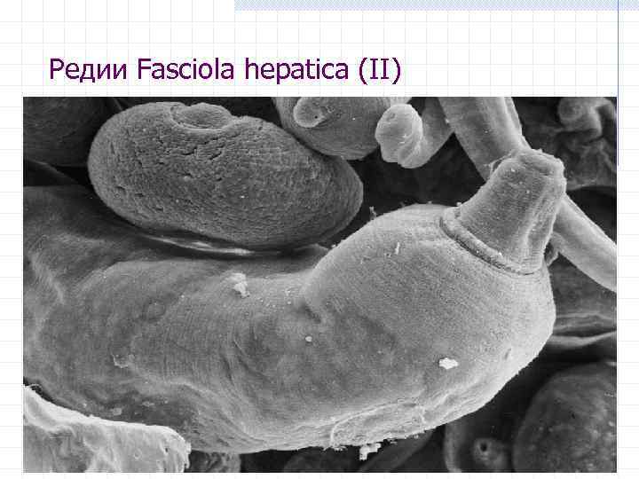 Редии Fasciola hepatica (II) 