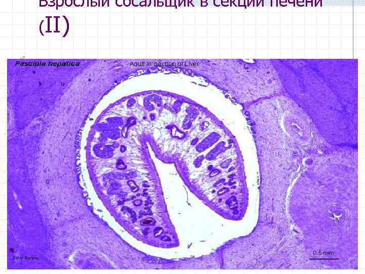 Взрослый сосальщик в секции печени (II) 