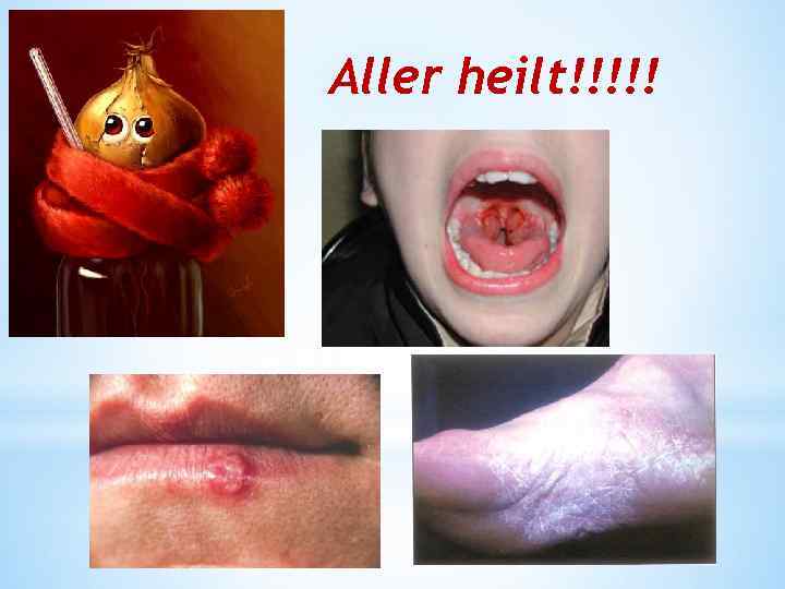Aller heilt!!!!! 