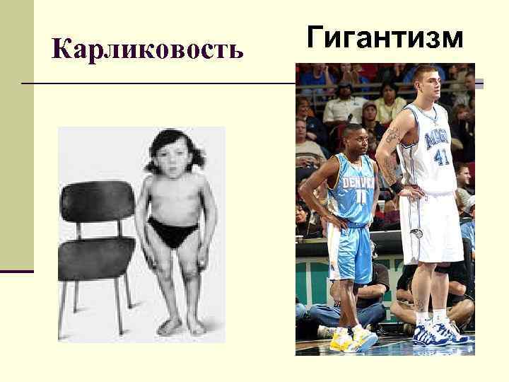 Карликовость Гигантизм 