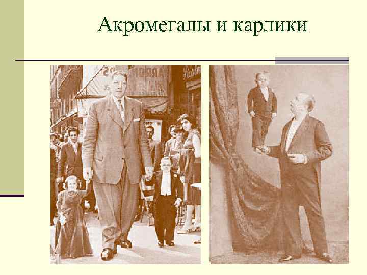 Акромегалы и карлики 