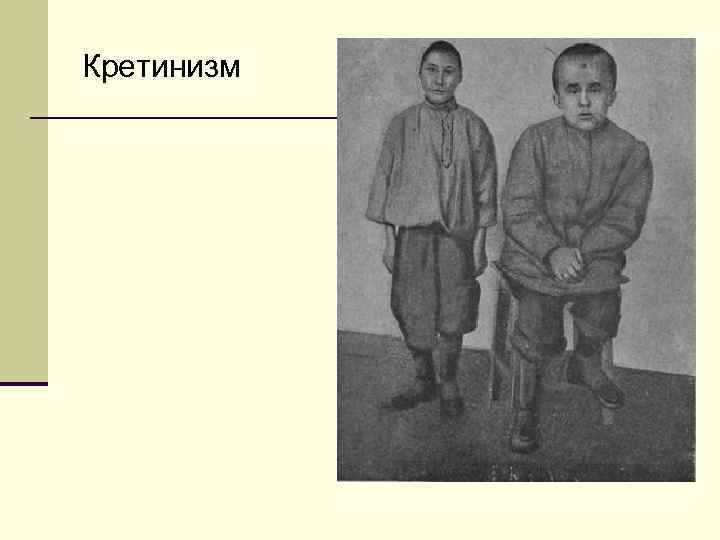 Кретинизм 