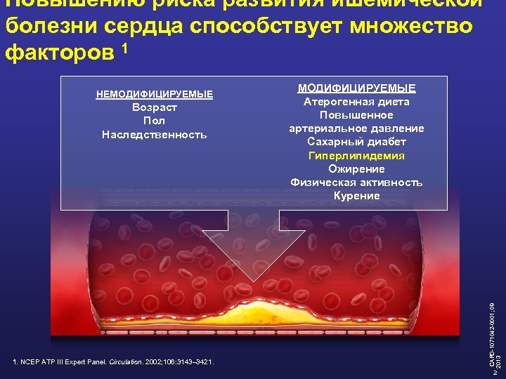 Повышению риска развития ишемической болезни сердца способствует множество факторов 1 Возраст Пол Наследственность 1.