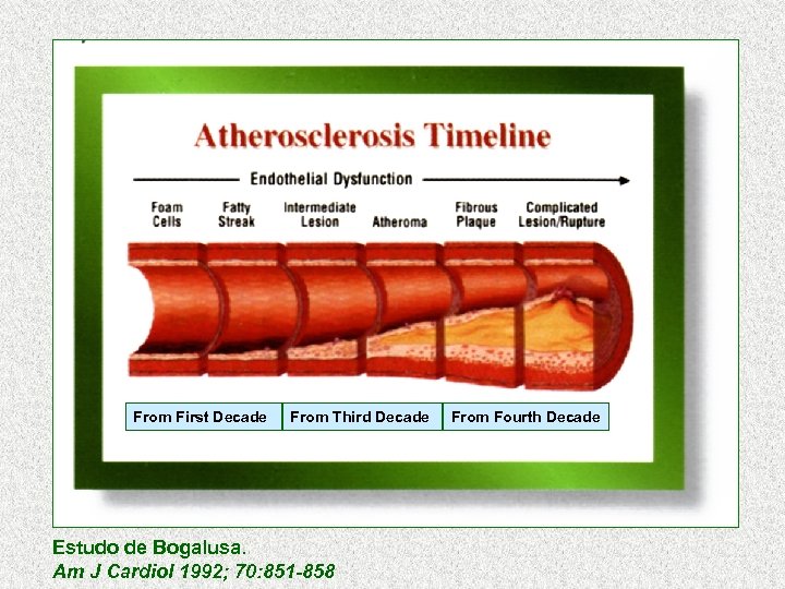 From First Decade From Third Decade Estudo de Bogalusa. Am J Cardiol 1992; 70: