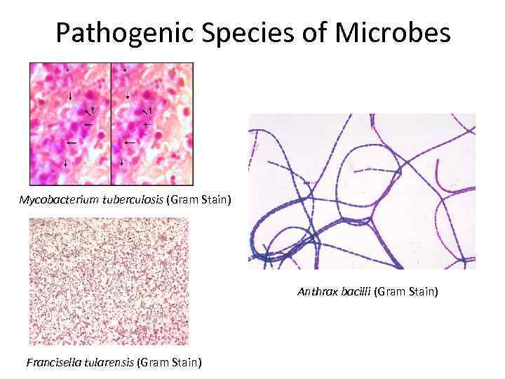 Pathogenic Species of Microbes Mycobacterium tuberculosis (Gram Stain) Anthrax bacilli (Gram Stain) Francisella tularensis