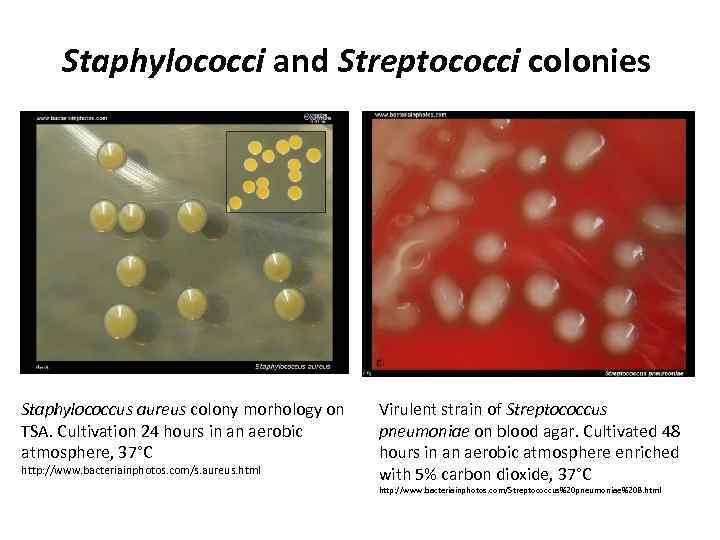 Staphylococci and Streptococci colonies Staphylococcus aureus colony morhology on TSA. Cultivation 24 hours in